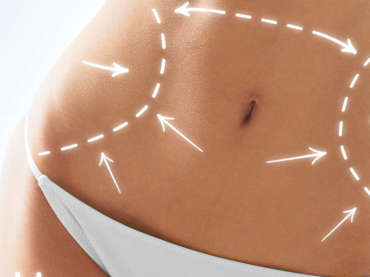 The fuller look breast augmentation