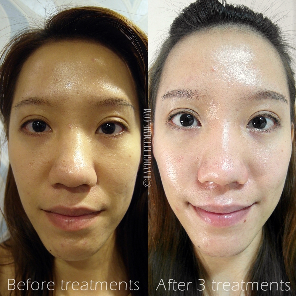 Vien Uong Sua Ong Chua Royal Jelly Learn The Right Way To Take Care Of Your Skin