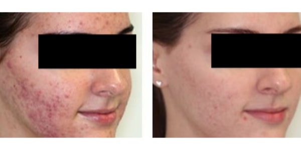 Before After Photos