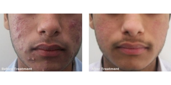 Before After Photos