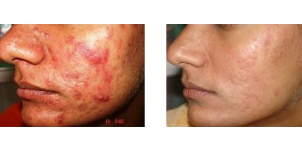 Before After Photos