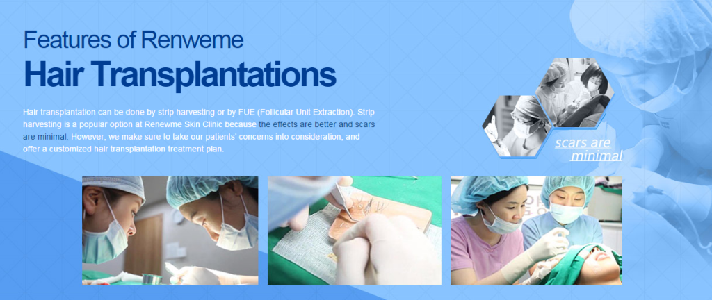 FUE hair transplant in chennai