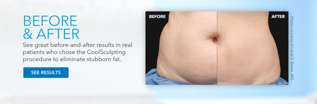 best weight loss treatment in chennai