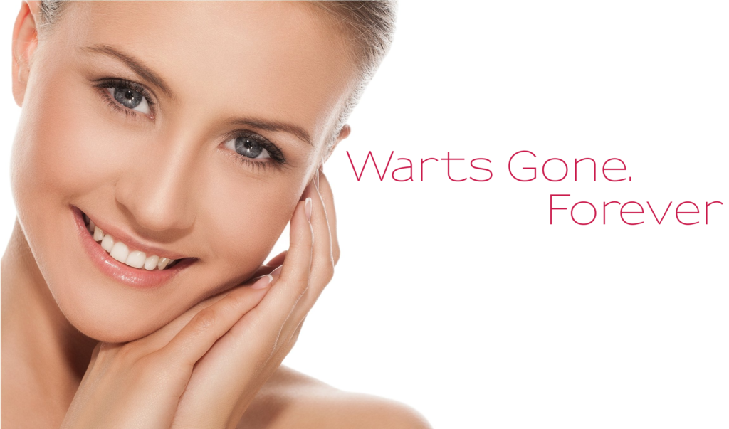 Get rid of warts, Now in Chennai